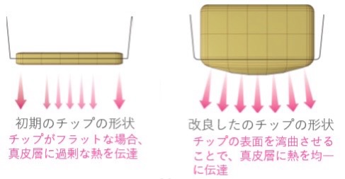 チップ