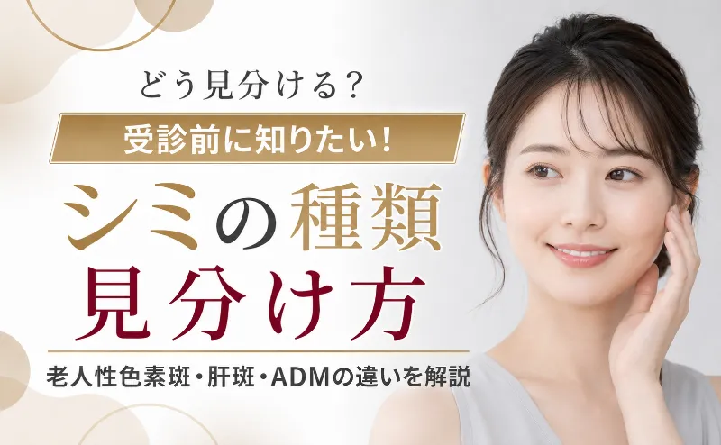 シミの種類と見分け方を解説！老人性色素斑と肝斑とADMの違い