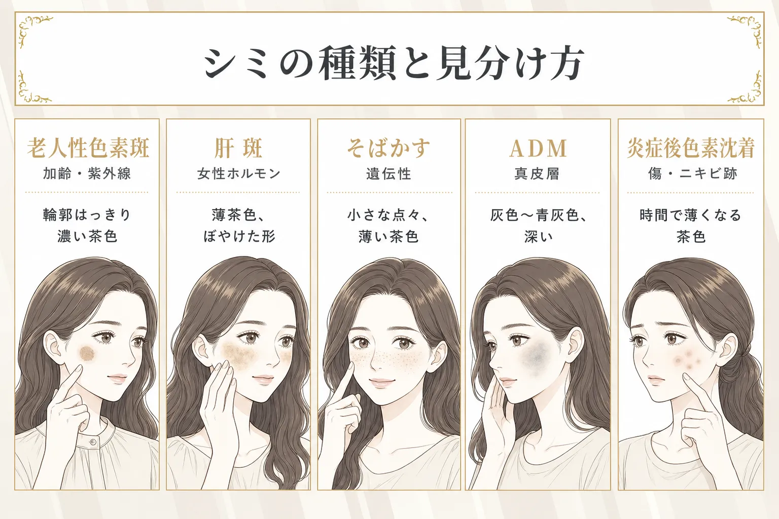 顔にできるシミの種類として老人性色素斑や肝斑などがあることを説明