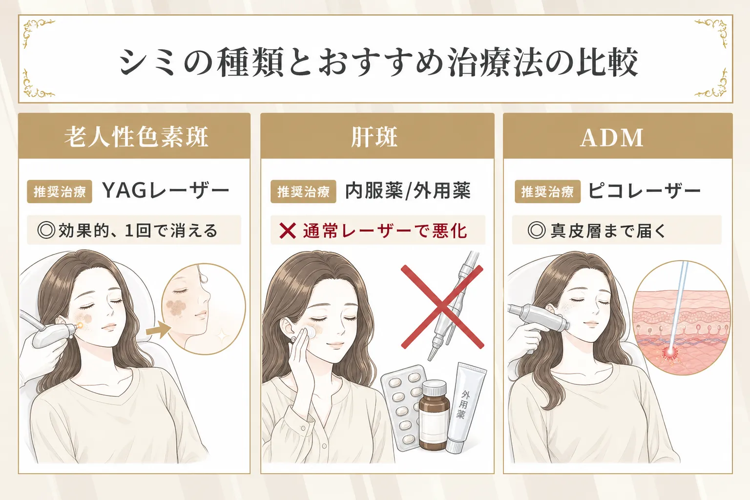 シミの種類によってレーザーや薬などの治療法が異なることを説明