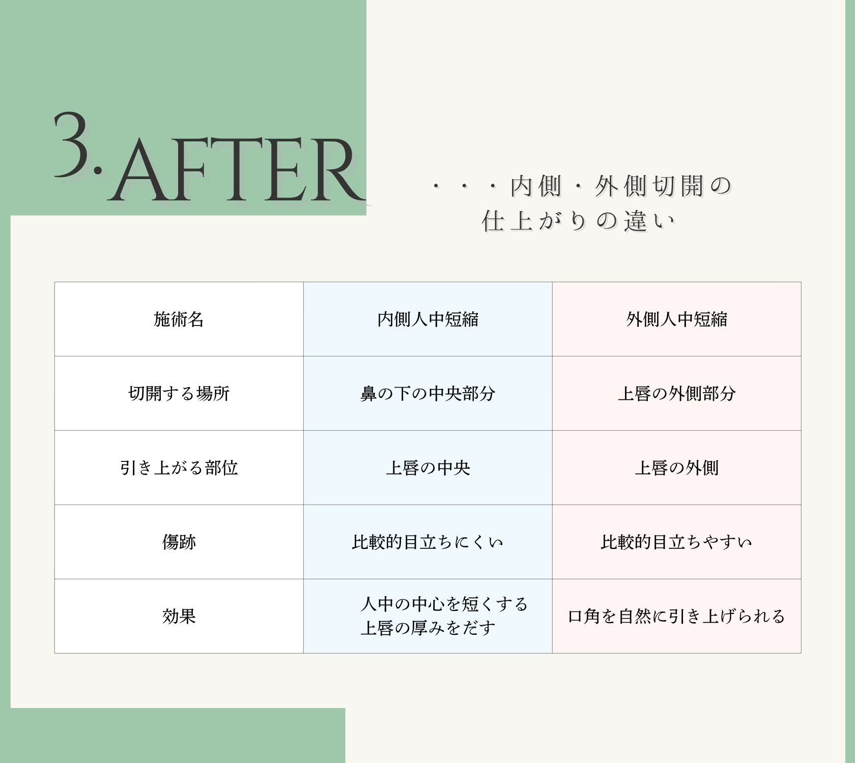 切開法内側・外側の違い